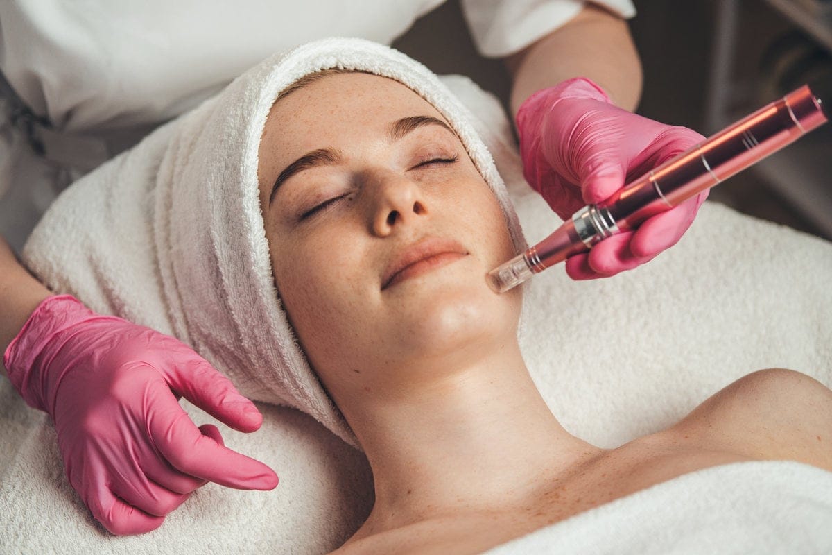 Lady getting Microneedling treatment | SkinPen® Microneedling in Skin Savvy Aesthetics | Franklin, MA