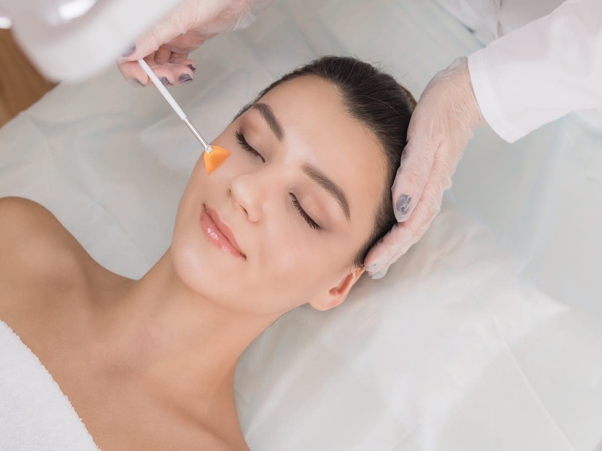 VI-Chemical-Peel-By-Skin-Savvy-Aesthetics-in-Franklin-MA