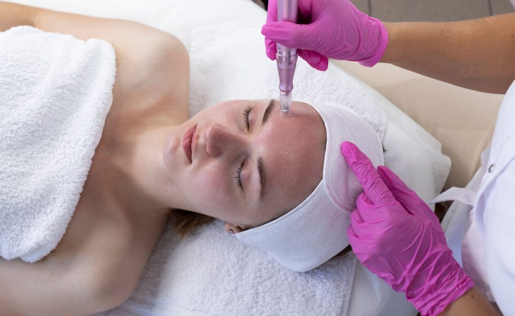 SkinPen® Microneedling vs. Other Treatments: What Makes It Stand Out 2 SkinPen-Microneedling-By-Skin-Savvy-Aesthetics-in-Franklin-MA