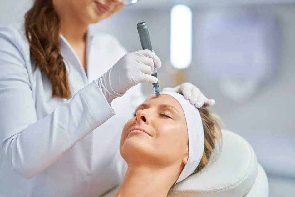 Blog 8 SkinPen Microneedling by Skin Savvy Aesthetics in St Foxboro, MA